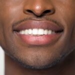 انواع باندینگ دندانپزشکی کدامند؟