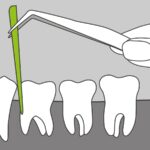 کن کاغذی دندانپزشکی
